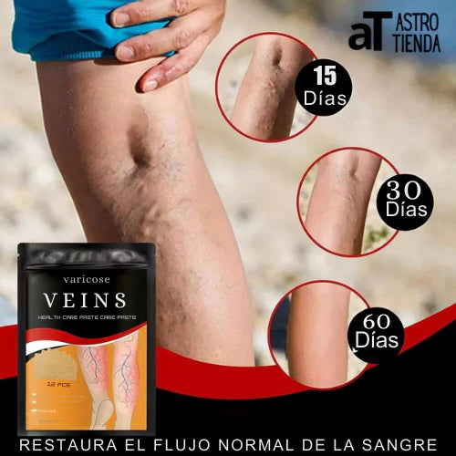 Parches Para Varices - VeinsFix 💜 ¡SUPER PROMO 2x1! LLEVA 24 PARCHES
