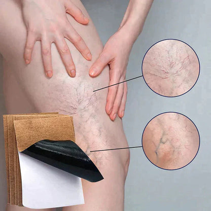 Parches Para Varices - VeinsFix 💜  ¡SUPER PROMO 2x1! LLEVA 24 PARCHES